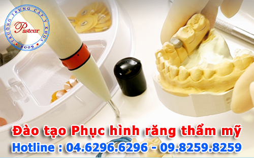 đào tạo kỹ thuật phục hình răng thẩm mỹ