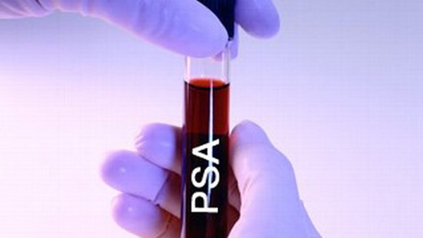 xét nghiệm psa